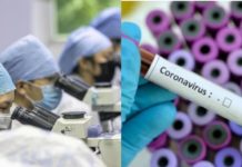 Coronavirus: isolato all’ospedale Sacco di Milano il ceppo italiano. Una buona notizia.