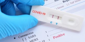 Castelnuovo, per un rientro sicuro a scuola, test rapidi per tutti gli alunni.